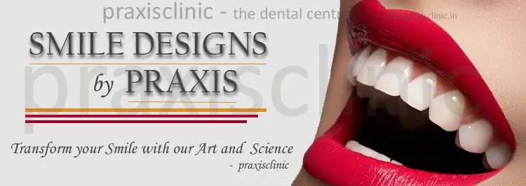 Best Smile Makeovers in Mumbai with Procelain and Composite Veneers