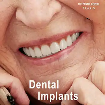 Best Dental Implants in Mumbai by Dr Varun Malhotra at PRAXIS Dental