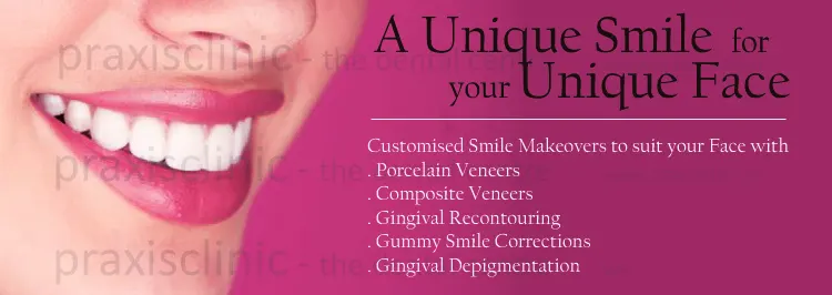 Smile Makeovers in Mumbai with Procelain and Composite Veneers