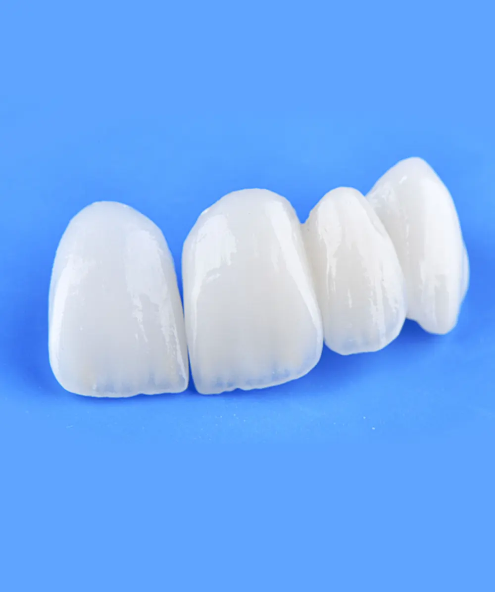 Zirconia veneers and ceramic crowns smile makeover before and after — PRAXIS Dental Mumbai Andheri India