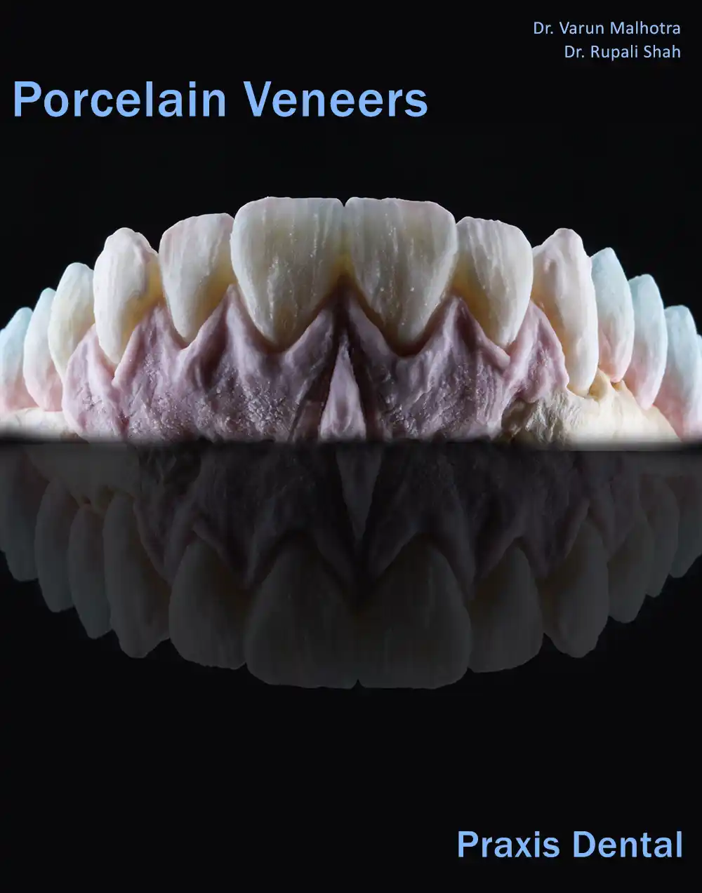 Porcelain veneers smile makeover before and after — best dentist for porcelain veneers near Andheri Vile Parle Mumbai India Dr Varun Malhotra PRAXIS Dental
