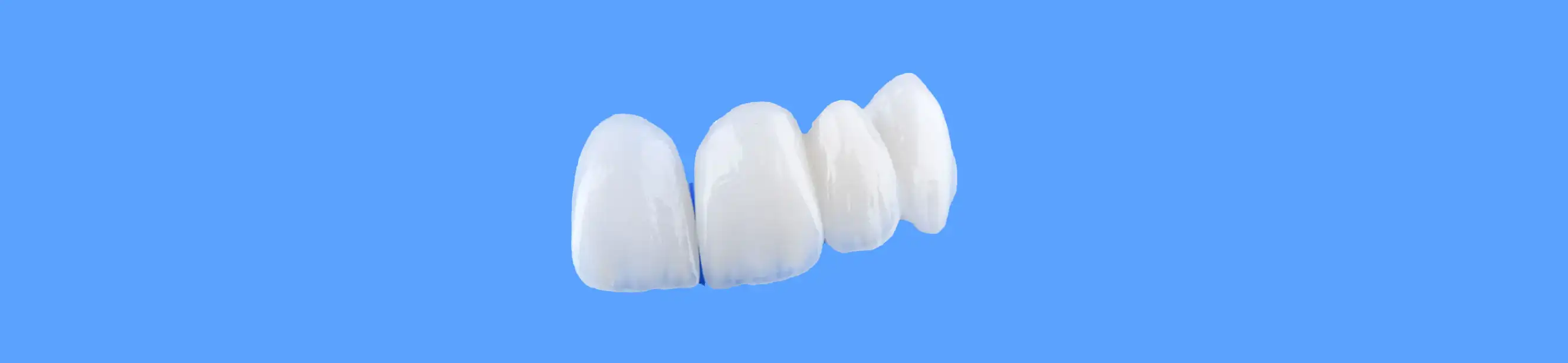 Porcelain veneers smile transformation at PRAXIS Dental  Mumbai — before and after